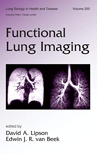 Functional Lung Imaging [Hardcover]