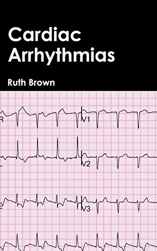 Cardiac Arrhythmias [Hardcover]