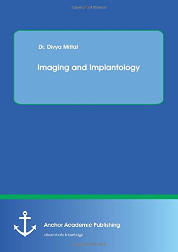 Imaging And Implantology [Paperback]