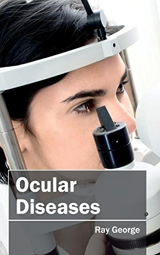 Ocular Diseases [Hardcover]