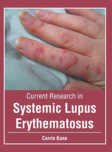 Current Research in Systemic Lupus Erythematosus [Hardcover]