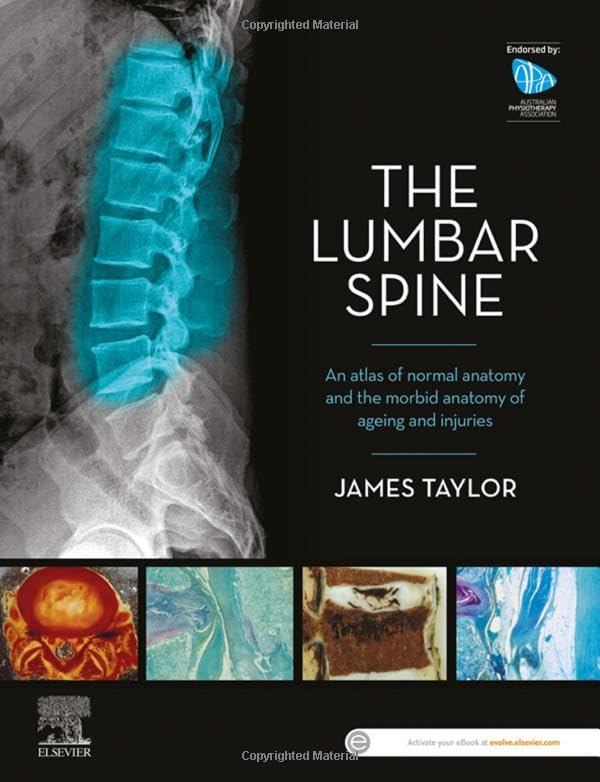 The Lumbar Spine: An Atlas of Normal Anatomy and the Morbid Anatomy of Ageing an [Paperback]