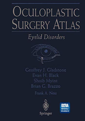 Oculoplastic Surgery Atlas: Eyelid Disorders [Paperback]