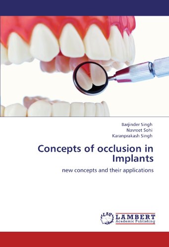 Concepts Of Occlusion In Implants Ne Concepts And Their Applications [Paperback]