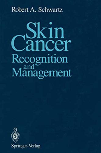 Skin Cancer: Recognition and Management [Paperback]