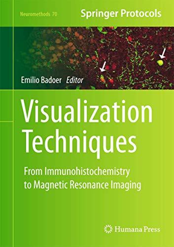 Visualization Techniques: From Immunohistochemistry to Magnetic Resonance Imagin [Hardcover]