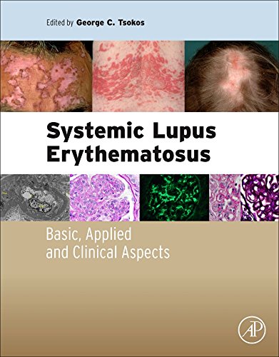 Systemic Lupus Erythematosus Basic, Applied and Clinical Aspects [Paperback]