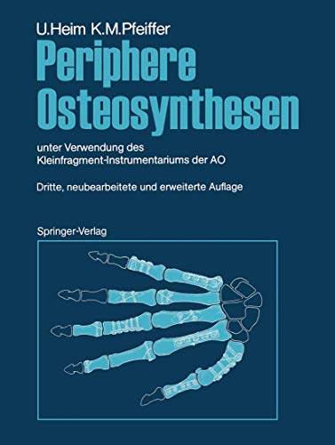 Periphere Osteosynthesen: unter Verwendung des Kleinfragment-Instrumentariums de [Paperback]