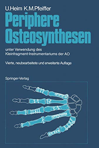 Periphere Osteosynthesen: unter Verwendung des Kleinfragment-Instrumentariums de [Paperback]