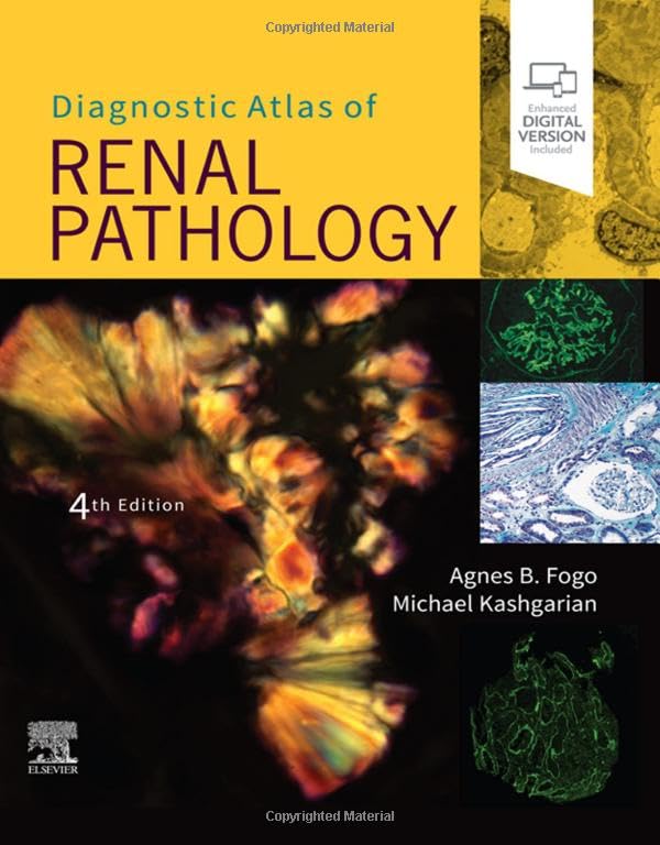 Diagnostic Atlas of Renal Pathology [Hardcover]