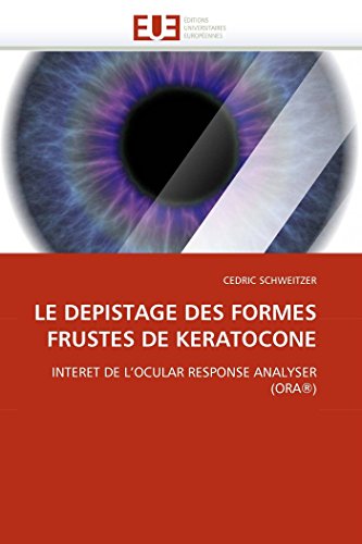 Le Depistage Des Formes Frustes De Keratocone Interet De L'ocular Response Anal [Paperback]