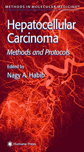 Hepatocellular Carcinoma: Methods and Protocols [Paperback]