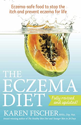 Eczema Diet: Eczema-safe food to stop the itc