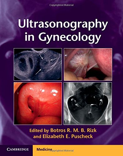 Ultrasonography In Gynecology [Hardcover]