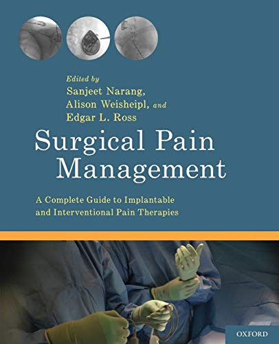 Surgical Pain Management A Complete Guide to Implantable and Interventional Pai [Paperback]