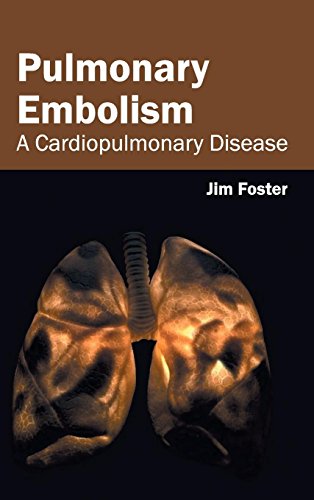 Pulmonary Embolism A Cardiopulmonary Disease [Hardcover]