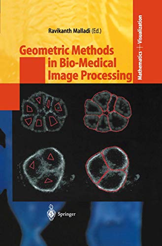 Geometric Methods in Bio-Medical Image Processing [Paperback]