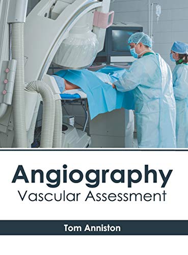 Angiography Vascular Assessment [Hardcover]