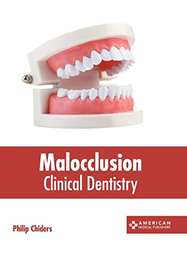 Malocclusion Clinical Dentistry [Hardcover]