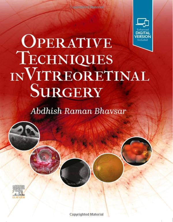 Operative Techniques in Vitreoretinal Surgery [Hardcover]