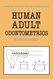 Human Adult Odontometrics The Study of Variation in Adult Tooth Size [Hardcover]