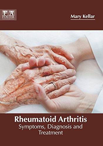 Rheumatoid Arthritis Symptoms, Diagnosis and Treatment [Hardcover]