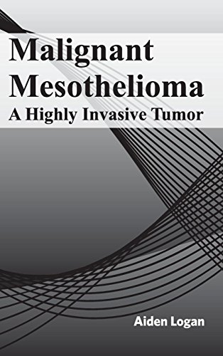 Malignant Mesothelioma A Highly Invasive Tumor [Hardcover]