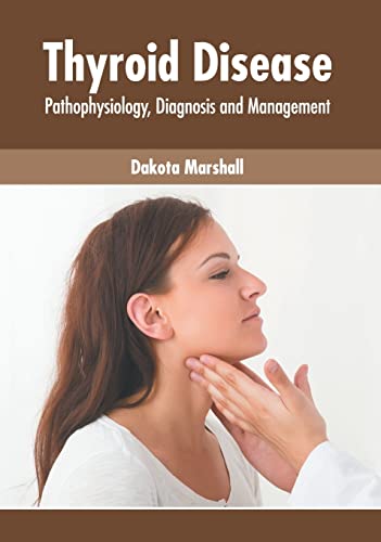 Thyroid Disease Pathophysiology, Diagnosis and Management [Hardcover]