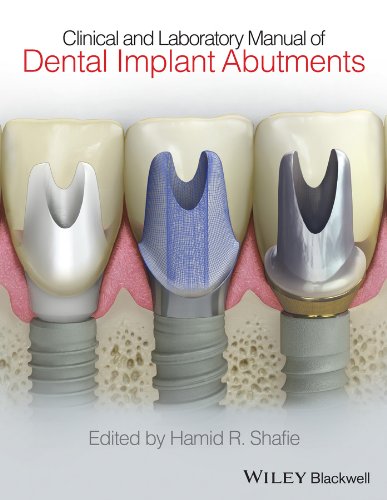 Clinical and Laboratory Manual of Dental Implant Abutments [Hardcover]