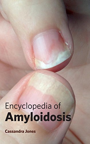 Encyclopedia Of Amyloidosis [Hardcover]