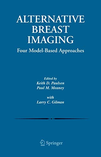 Alternative Breast Imaging Four Model-Based Approaches [Hardcover]