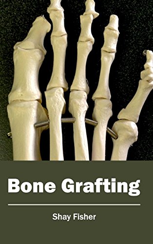 Bone Grafting [Hardcover]