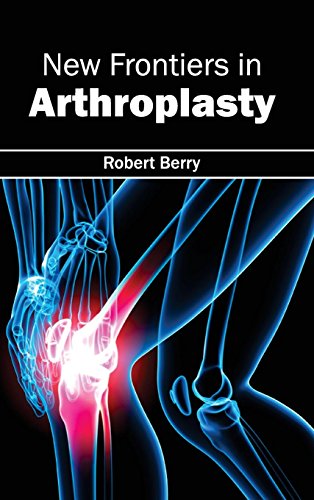 Ne Frontiers In Arthroplasty [Hardcover]