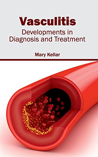 Vasculitis Developments In Diagnosis And Treatment [Hardcover]