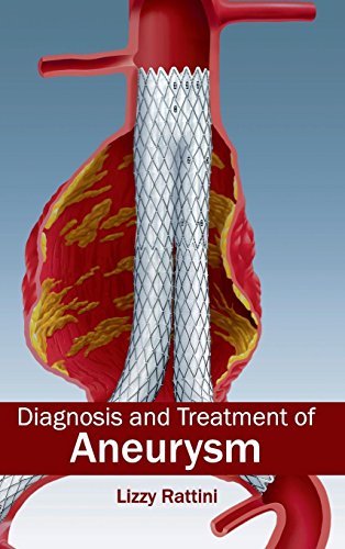 Diagnosis And Treatment Of Aneurysm [Hardcover]