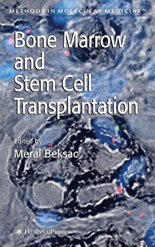 Bone Marrow and Stem Cell Transplantation [Paperback]