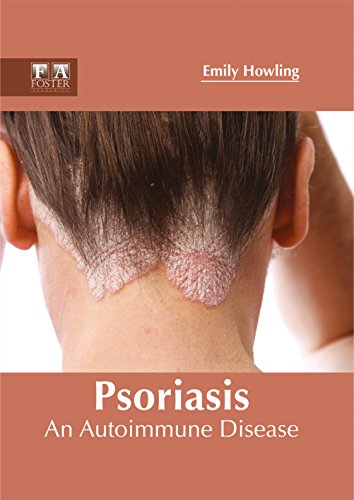 Psoriasis An Autoimmune Disease [Hardcover]