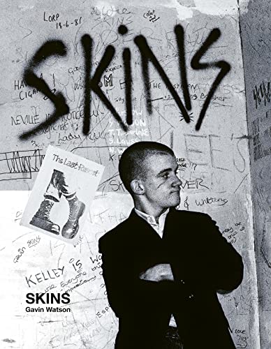 Skins: Gavin Watson [Hardcover]