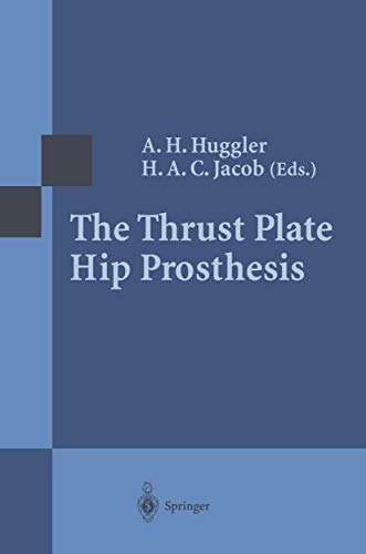 The Thrust Plate Hip Prosthesis [Paperback]