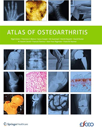 Atlas of Osteoarthritis [Paperback]