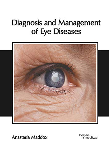 Diagnosis and Management of Eye Diseases [Hardcover]