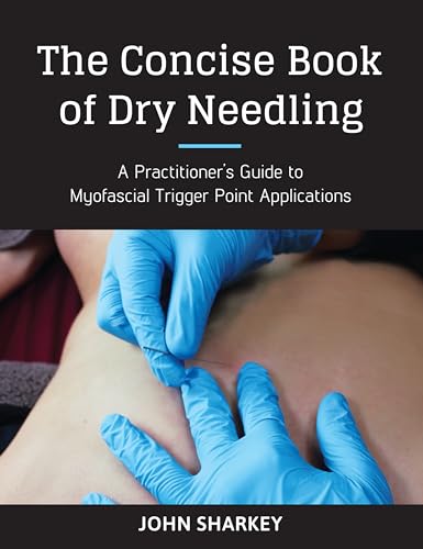 The Concise Book of Dry Needling: A Practitioner's Guide to Myofascial Trigger P [Paperback]