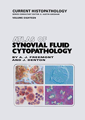 Atlas of Synovial Fluid Cytopathology [Paperback]