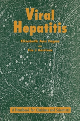 Viral Hepatitis [Paperback]