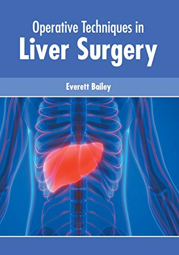 Operative Techniques in Liver Surgery [Hardcover]