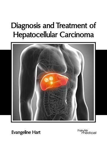 Diagnosis and Treatment of Hepatocellular Carcinoma [Hardcover]