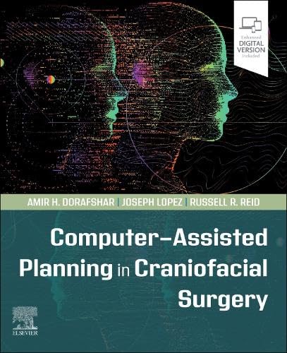 Computer-Assisted Planning in Craniofacial Surgery [Paperback]