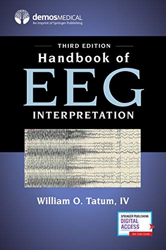 Handbook of EEG Interpretation [Paperback]