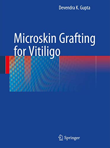 Microskin Grafting for Vitiligo [Hardcover]