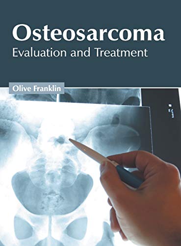 Osteosarcoma Evaluation and Treatment [Hardcover]